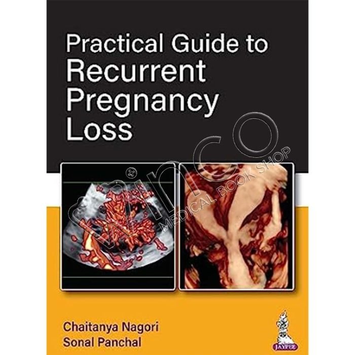 Practical Guide to Recurrent Pregnancy Loss