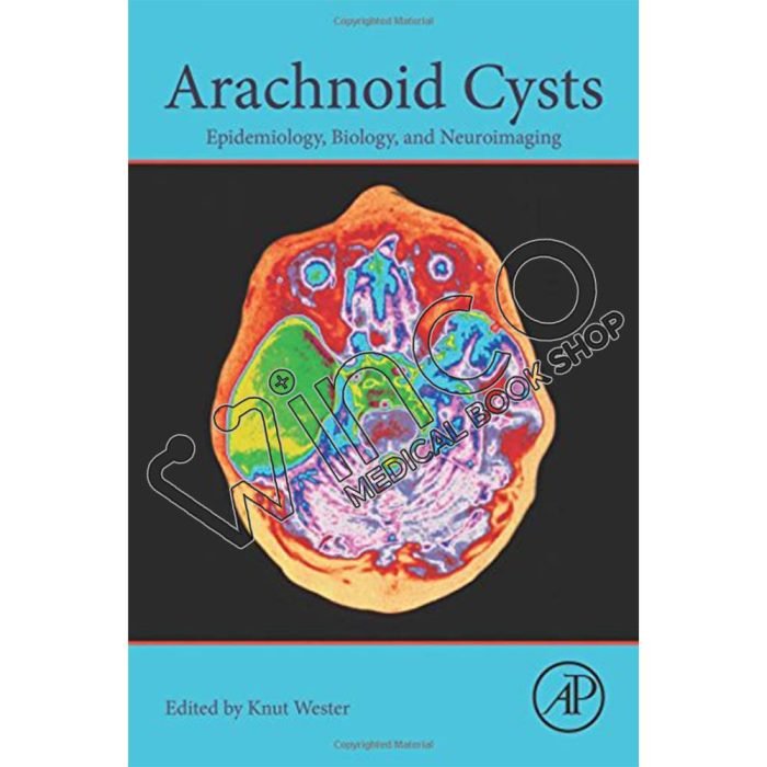 Arachnoid Cysts: Epidemiology, Biology, and Neuroimaging