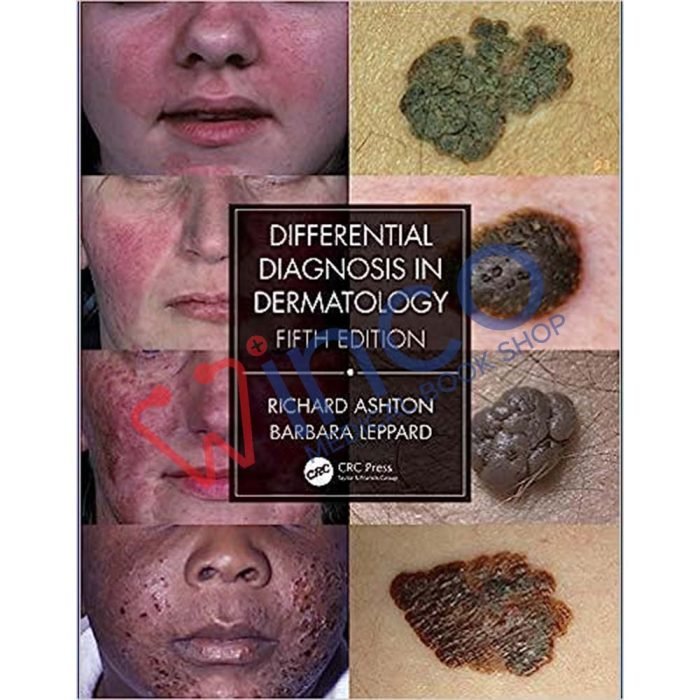 Differential Diagnosis in Dermatology 5th Edition