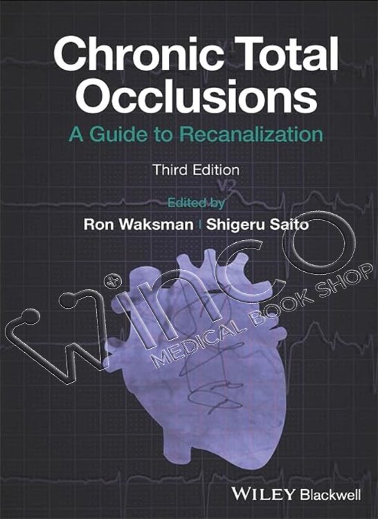 Chronic Total Occlusions
