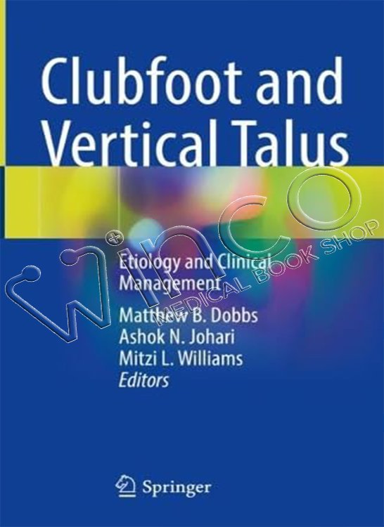 Clubfoot and Vertical Talus Etiology and Clinical Management