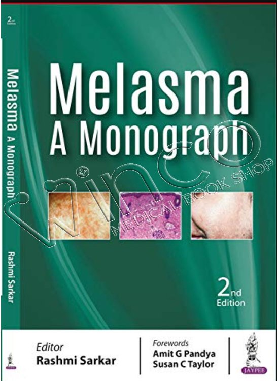 Melasma A Monograph, 2nd Edition