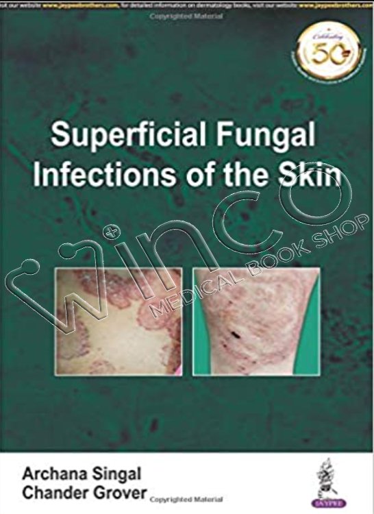 Superficial Fungal Infections of the Skin