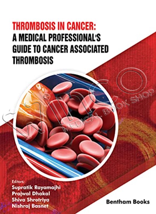 Thrombosis in Cancer