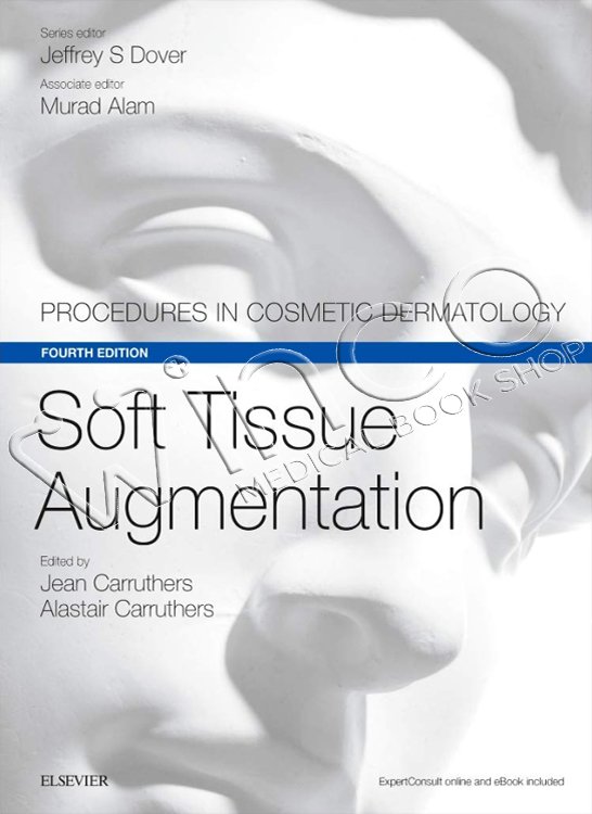 soft tissue augmentation