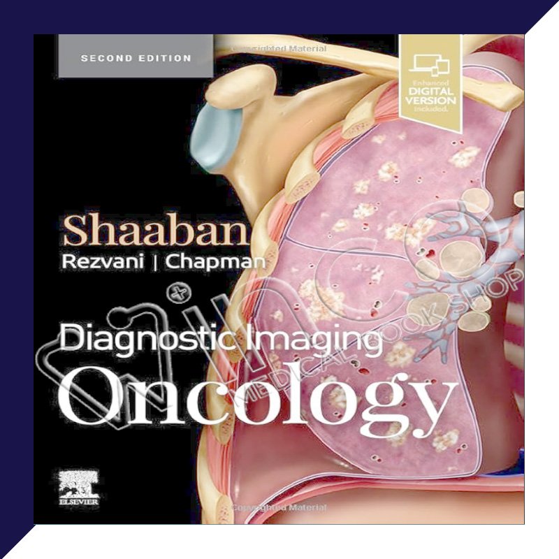 Diagnostic Imaging Oncology, 2nd Edition