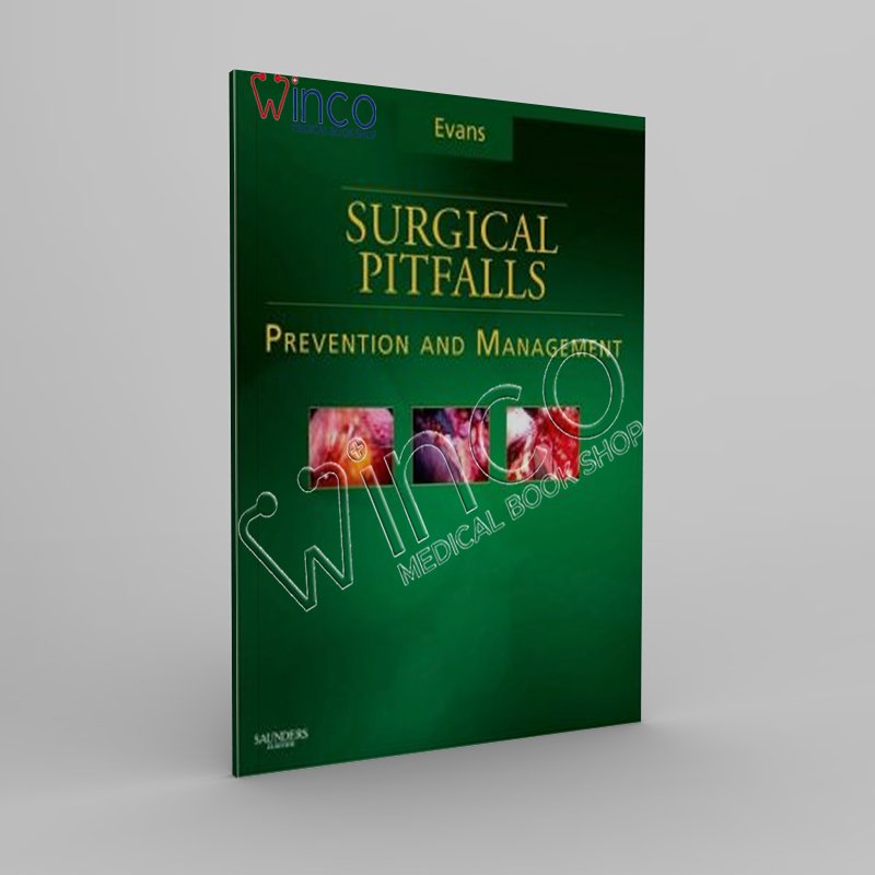 Surgical Pitfalls Prevention and Management