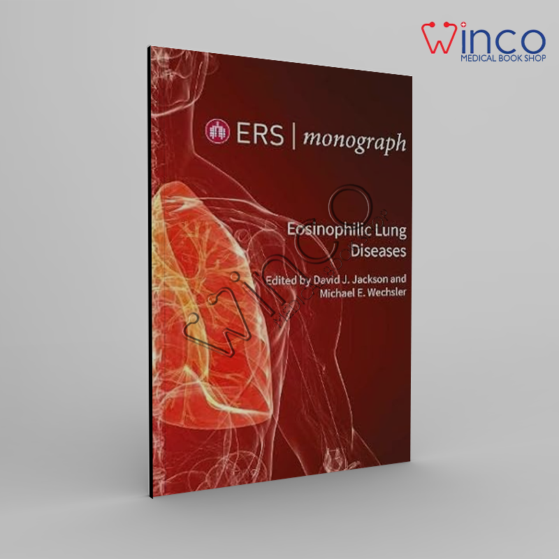 Asthma (ERS Monograph 108), 2nd Edition