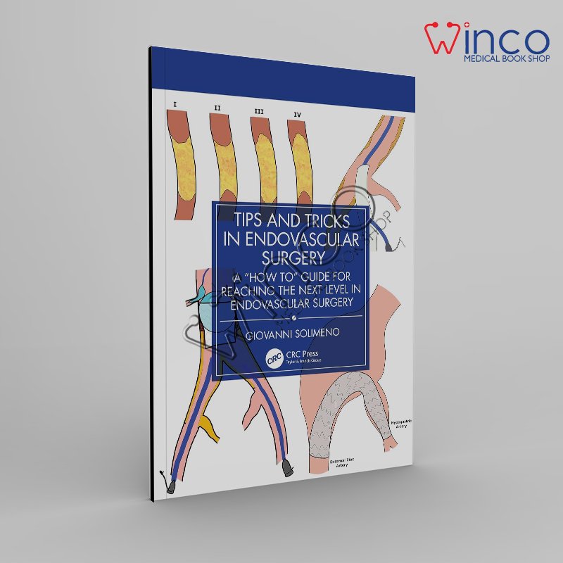 Tips and Tricks in Endovascular Surgery: A "How to" Guide for reaching the next Level in Endovascular Surgery 1st Edition
